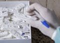Governo Federal distribui mais 28,2 milhões de testes rápidos para Covid-19 em janeiro