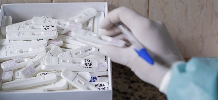 Governo Federal distribui mais 28,2 milhões de testes rápidos para Covid-19 em janeiro
