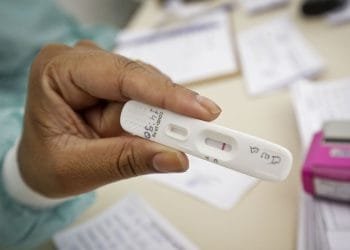 Anvisa aprova uso e comercialização de autoteste para covid-19