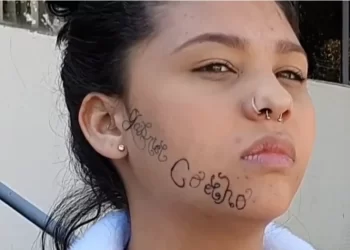 Jovem que teve rosto tatuado por ex: “Me matou por dentro”