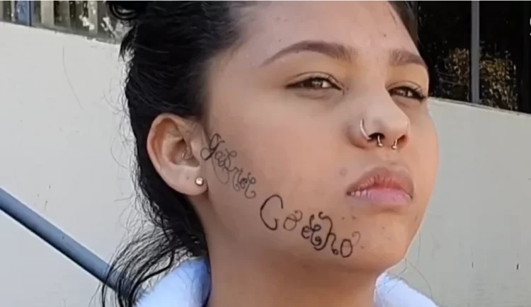 Jovem que teve rosto tatuado por ex: “Me matou por dentro”