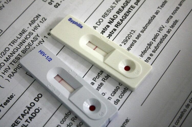 Unidade de Saúde Ilion Fleury realiza ações de prevenção no Dia Mundial de Luta Contra a Aids