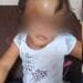 Polícia Civil prende responsáveis por desfigurar rosto de criança de 4 anos