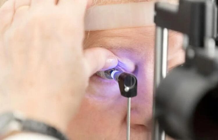 Transplante de córnea: 33 mil pessoas aguardam cirurgia no Brasil