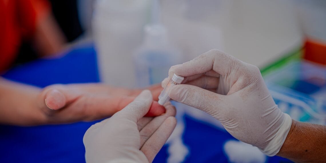 Julho Amarelo: Prefeitura intensifica ações de prevenção às hepatites virais com testes rápidos e vacinação